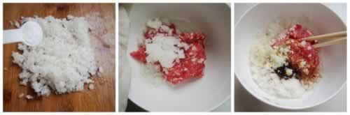 �ܲ��Źǵ�����