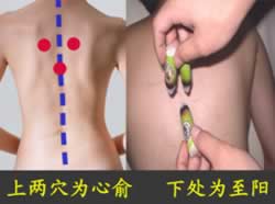 ʧ�ߵİ������Ʒ�����ͼ��